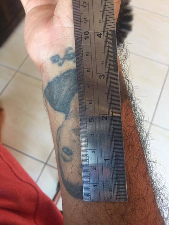 jasa hapus tattoo di bali