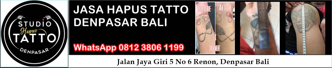 spanduk studio hapus tatto